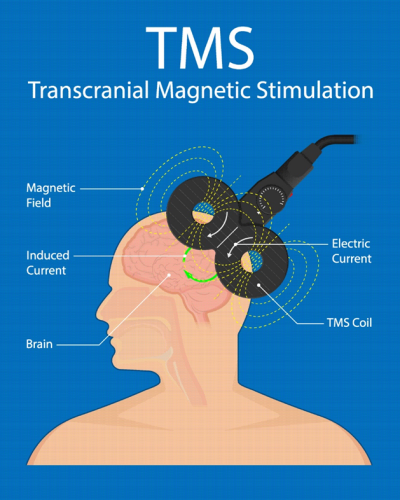 Export of neuroscience goods